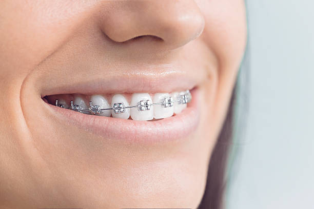 Best Dental Fillings (Composite and Amalgam)  in Brooklyn, IN
